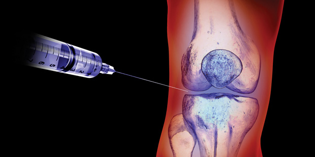 Knee Osteoarthritis: Steroid Injections Offer No Benefit, Study Suggests