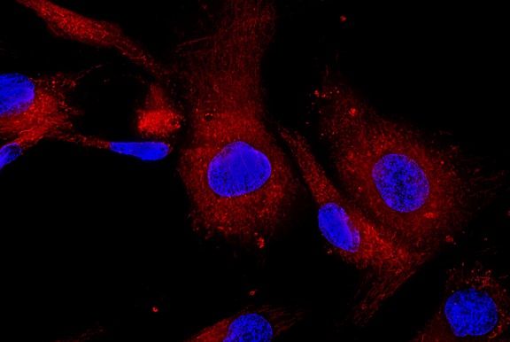 How The Bone Marrow Aspiration Technique Affects Stem Cell Counts   Bone Marrow Aspiration Technique 1k 