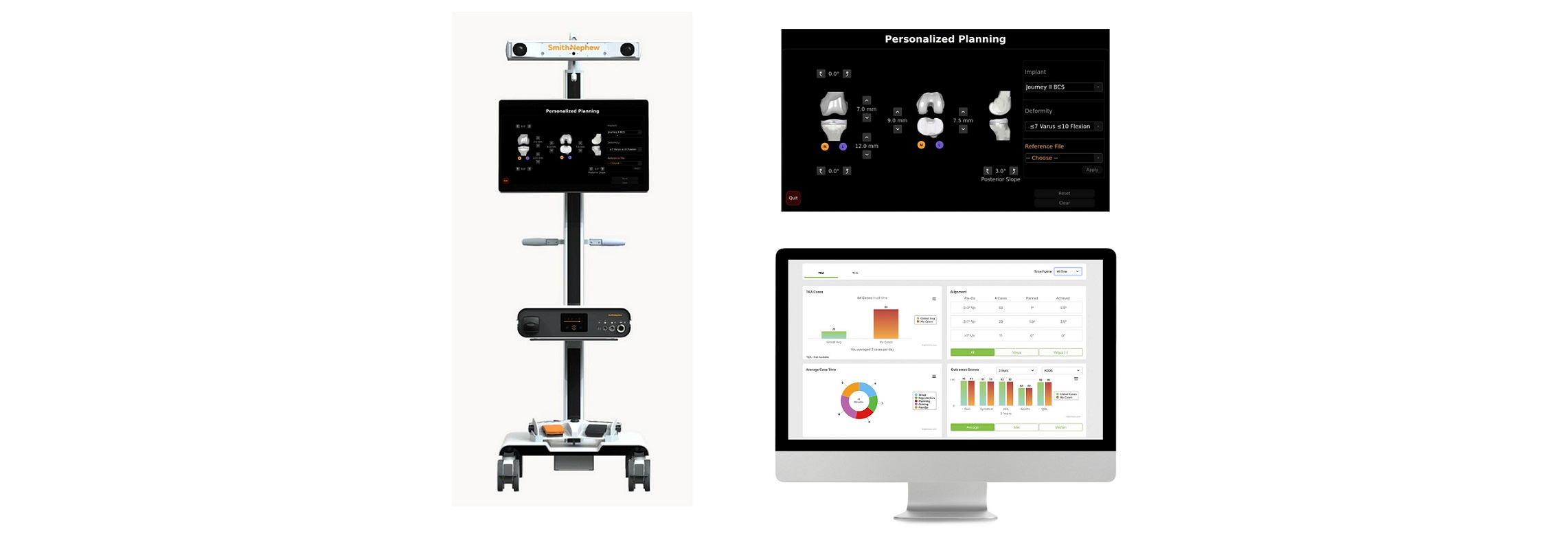 Smithnephew Helps Personalize Robotically Enabled Surgery With Ai