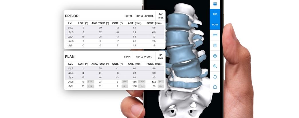 Back in Action: Discussing the Spine Technology Market