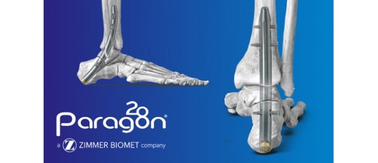 Zimmer Biomet Launches Advancement for Hindfoot Fusion – Ortho Spine News